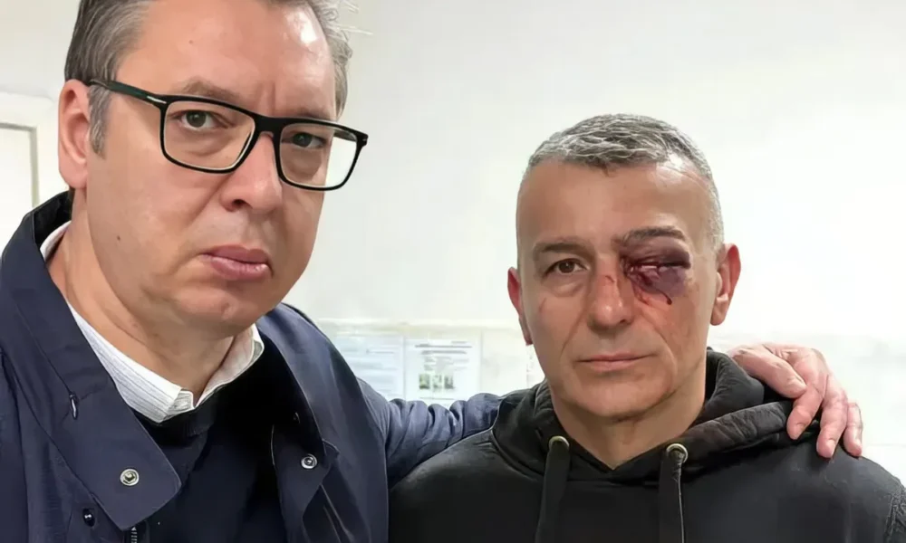 A belgrádi incidensek során súlyosan megsérült egy rendőr, akinek be van dagadva a bal szeme
