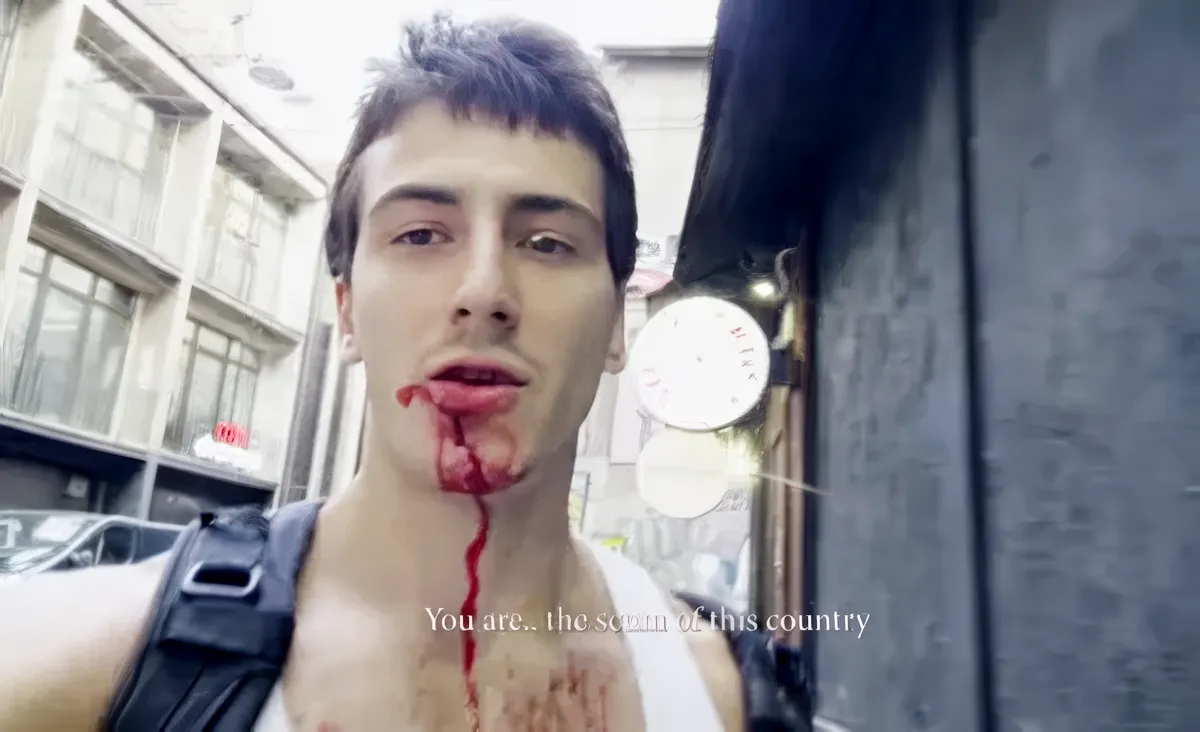 Horogkereszt Belgrádban is, ébredezik az antiszemitizmus 4 Ti vagytok ennek az országnak a söpredéke - állapította meg a vérzőszájú youtuber